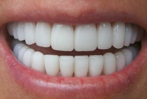 Cosmetic Dentistry