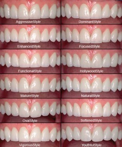 Porcelain Veneers