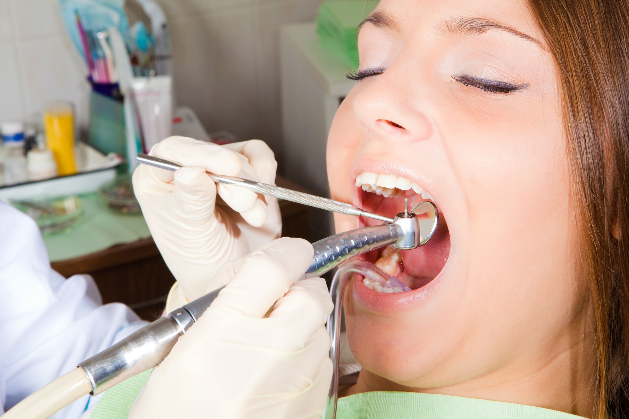 Amazing Tips For Finding a Good Cosmetic Dentist in Ames, IA