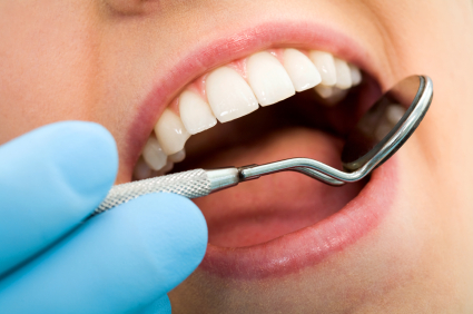 Importance of Teeth Cleaning in Rochester MN