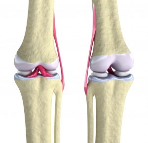 When to See a Physician for Knee Pain Treatment in St Louis MO