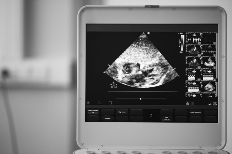 What are the Benefits of Using a Portable Veterinary Ultrasound